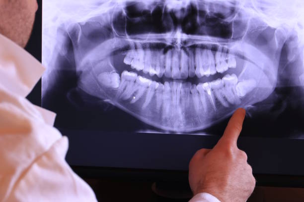 Best Walk-In Emergency Dentist in Warrenton, VA