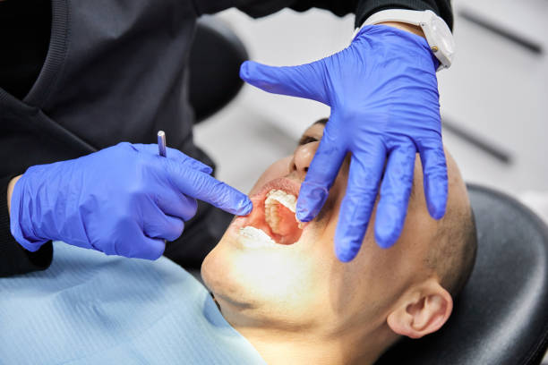 Best Emergency Tooth Extraction in Warrenton, VA