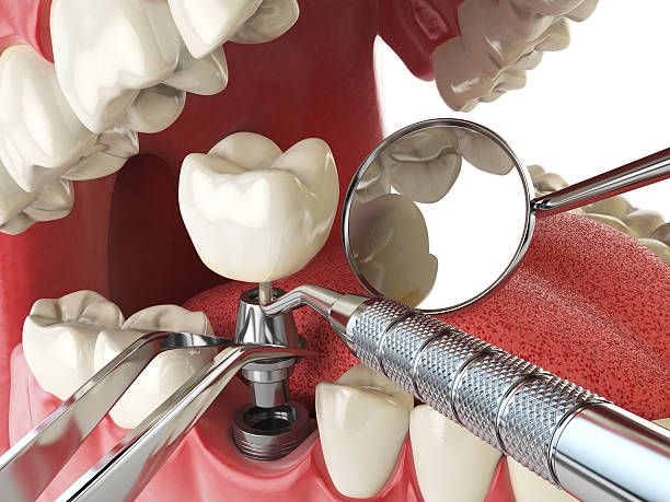 Best Emergency Dental Care for Trauma or Injury in Warrenton, VA